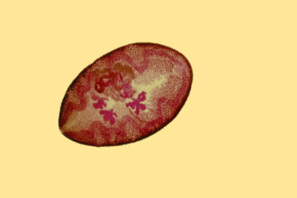 吸虫是什么虫